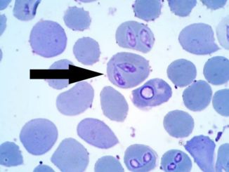 Piroplasma canis – паразит, который локализуется в клетках крови, таких как: эритроциты, нейтрофилах, плазме крови, иногда в паренхиматозных тканях.